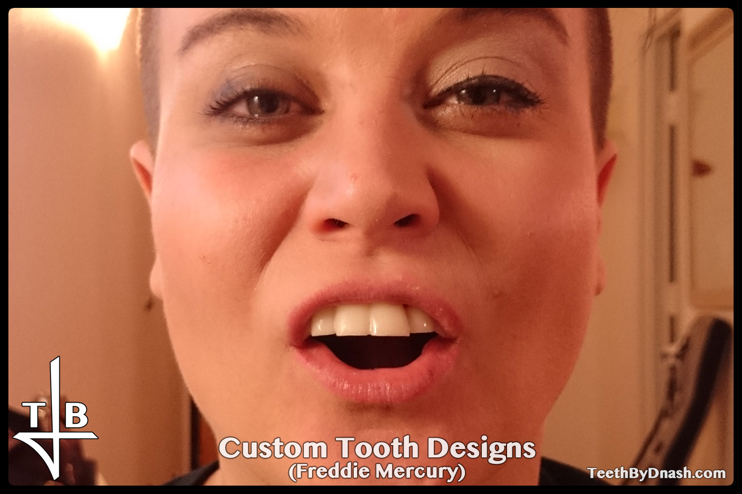 http://custom_designs-freddie_mercury-teeth_by_dnash-01