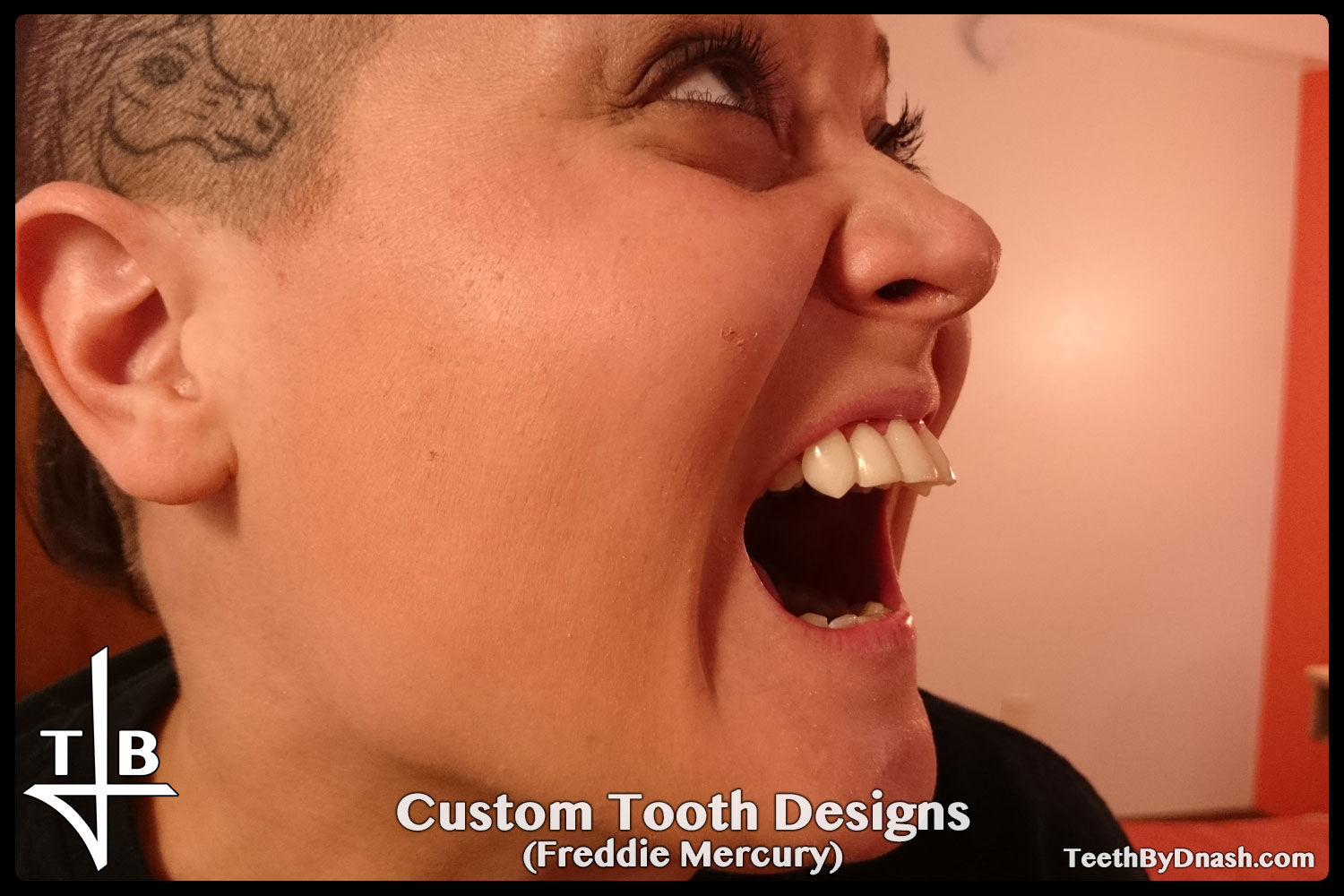 http://custom_designs-freddie_mercury-teeth_by_dnash-05