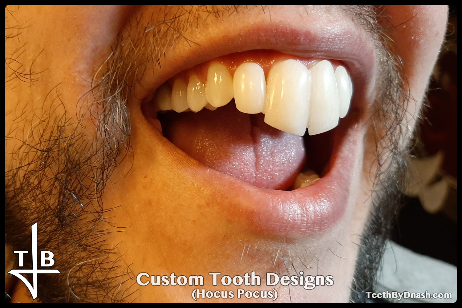 http://custom_designs-hocus_pocus-teeth_by_dnash-002