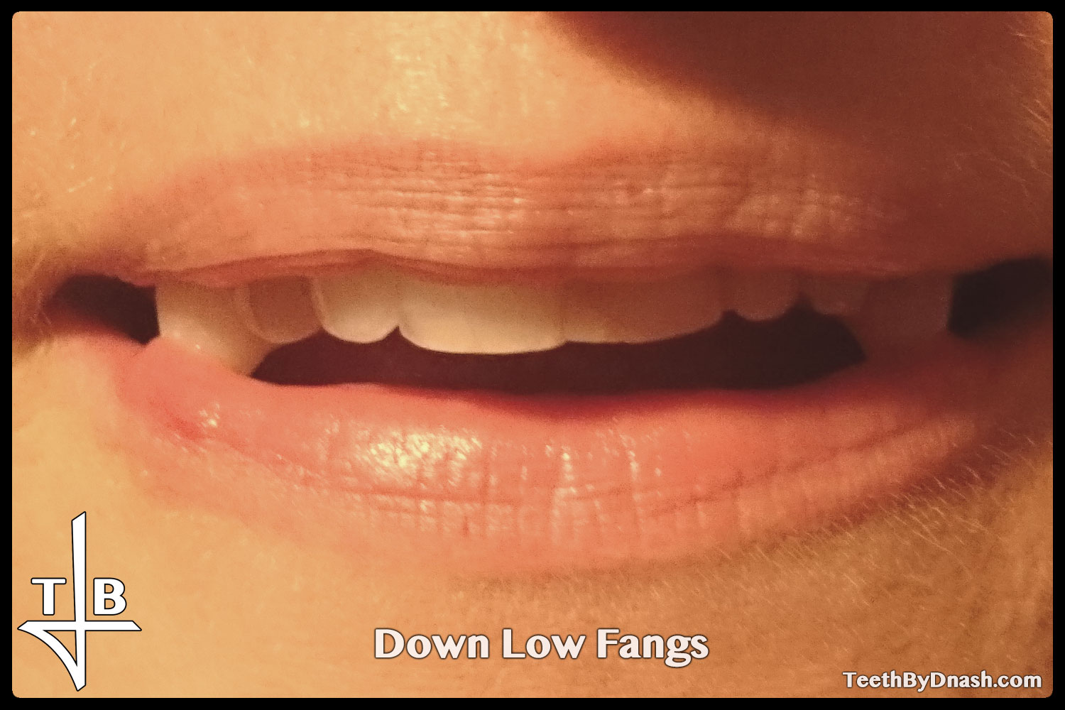 http://down_low-custom_fangs-teeth_by_dnash-01