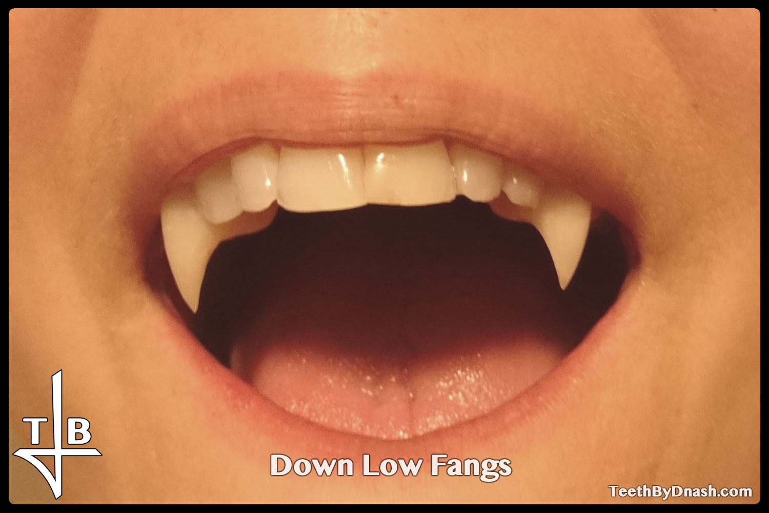 http://down_low-custom_fangs-teeth_by_dnash-02