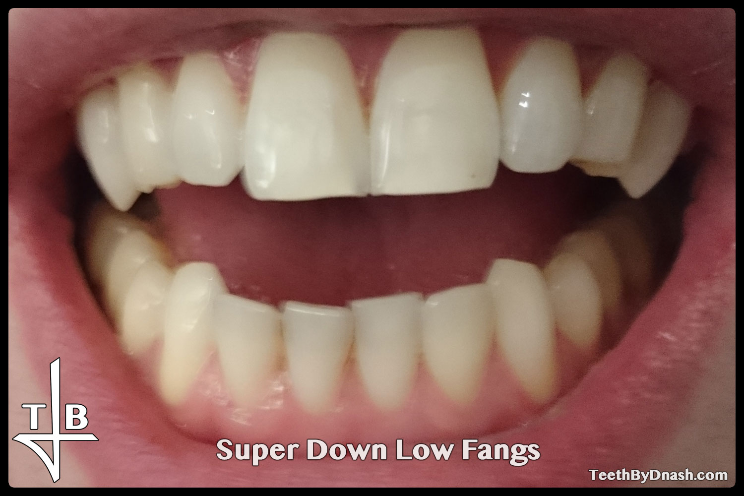 http://super_down_low-custom_fangs-teeth_by_dnash-01