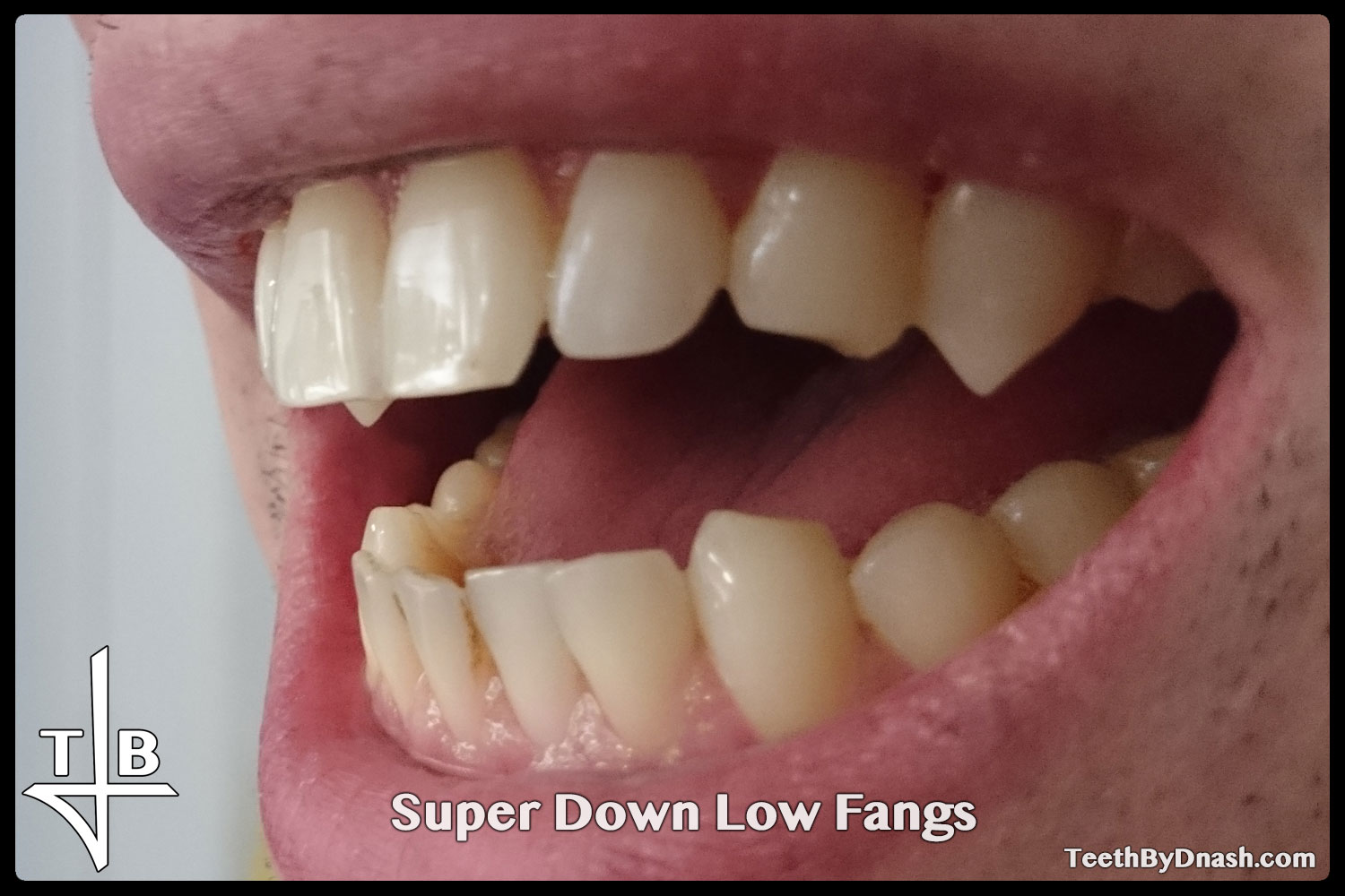 http://super_down_low-custom_fangs-teeth_by_dnash-02