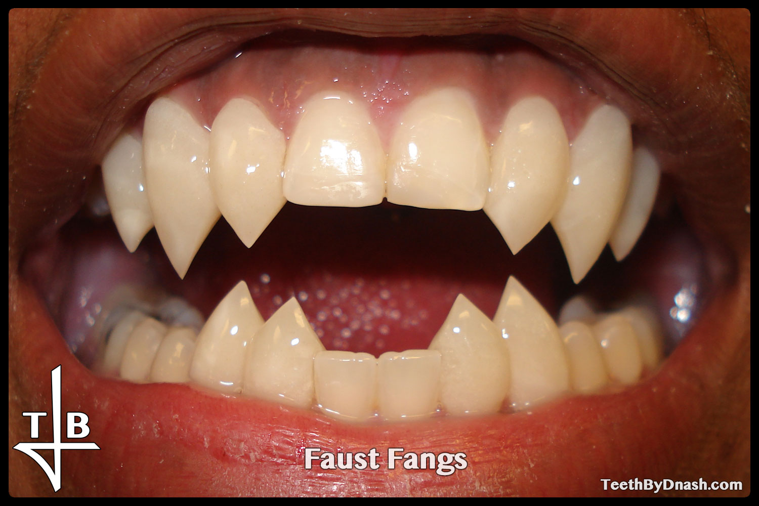 http://faust-custom_fangs-teeth_by_dnash-02