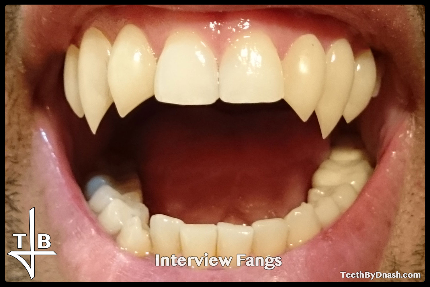 http://interview-custom_fangs-teeth_by_dnash-01