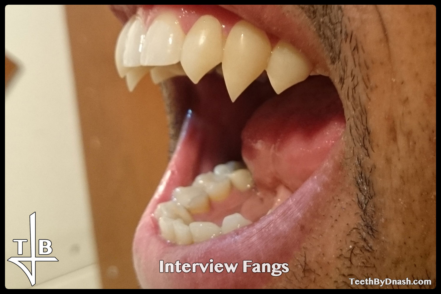 http://interview-custom_fangs-teeth_by_dnash-02