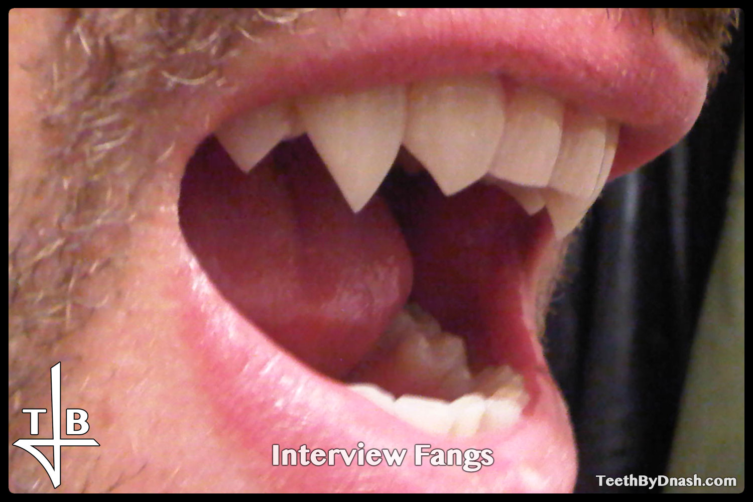 http://interview-custom_fangs-teeth_by_dnash-12