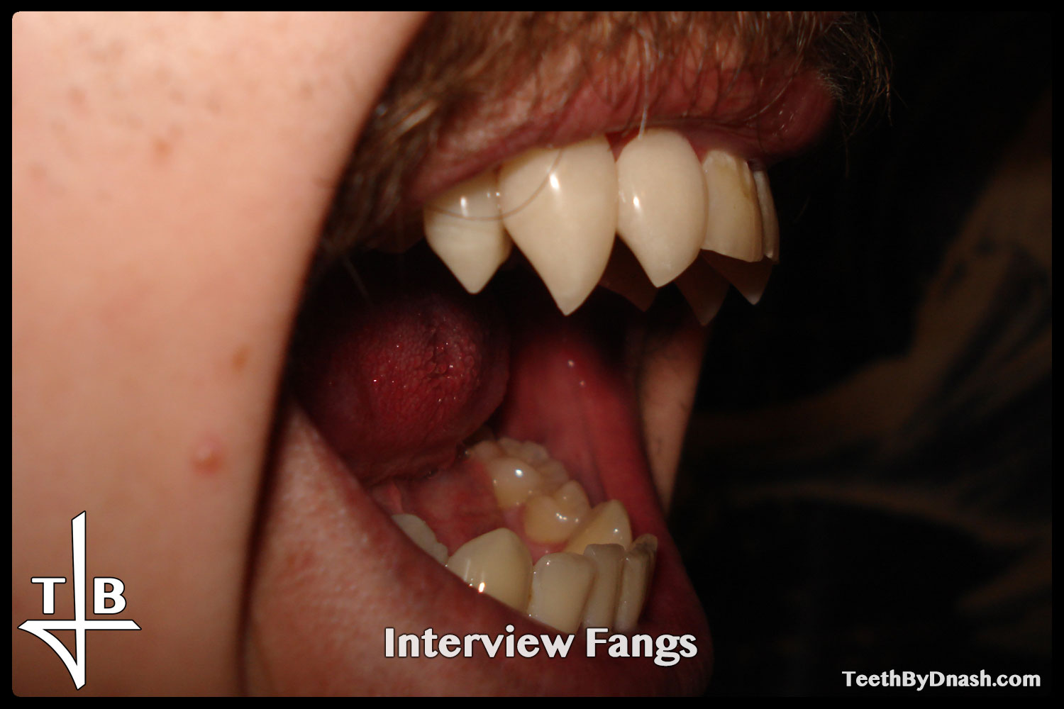 http://interview-custom_fangs-teeth_by_dnash-14