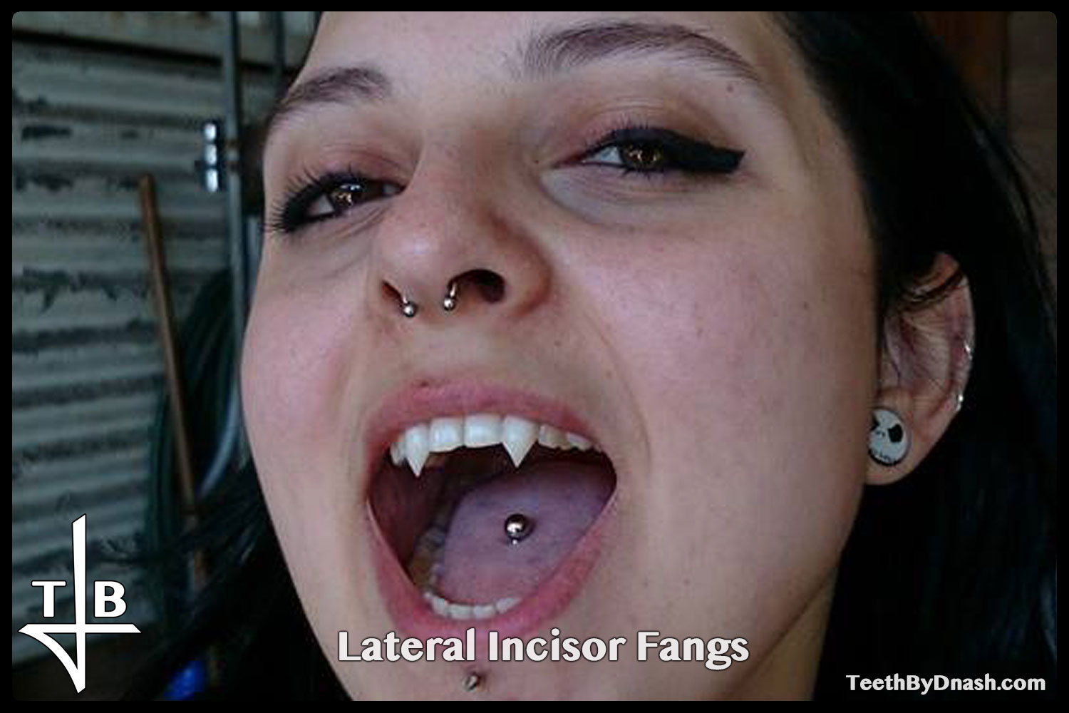 http://lateral_incisor-custom_fangs-teeth_by_dnash-01