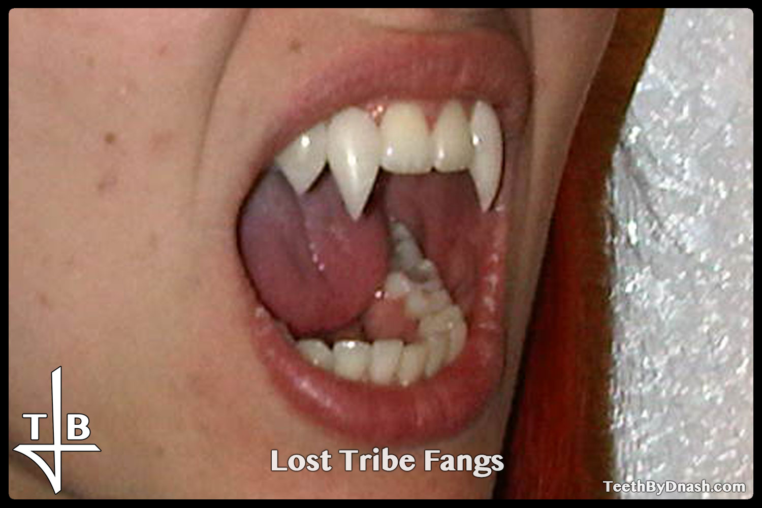 http://lost_tribe-custom_fangs-teeth_by_dnash-02