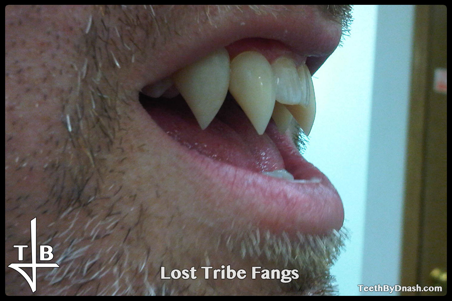 http://lost_tribe-custom_fangs-teeth_by_dnash-09