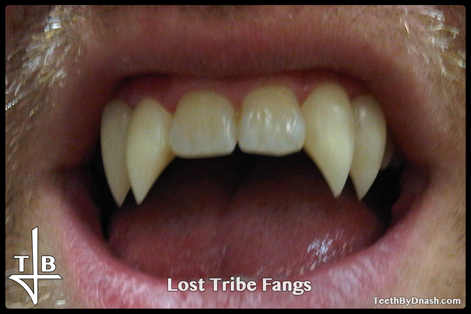 http://lost_tribe-custom_fangs-teeth_by_dnash-10