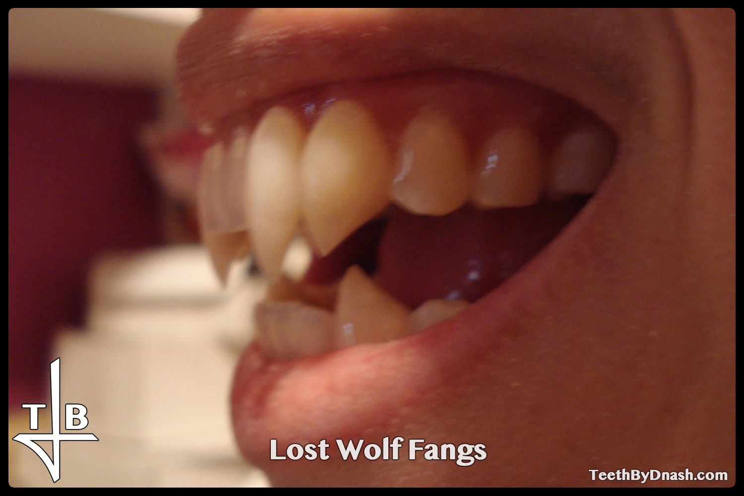 http://lost_wolf-custom_fangs-teeth_by_dnash-03