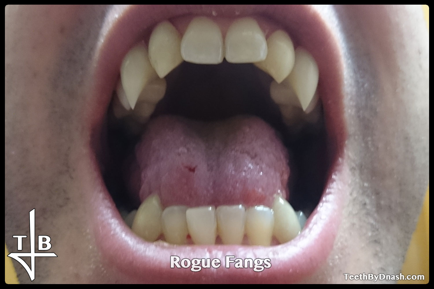 http://rogue-custom_fangs-teeth_by_dnash-03