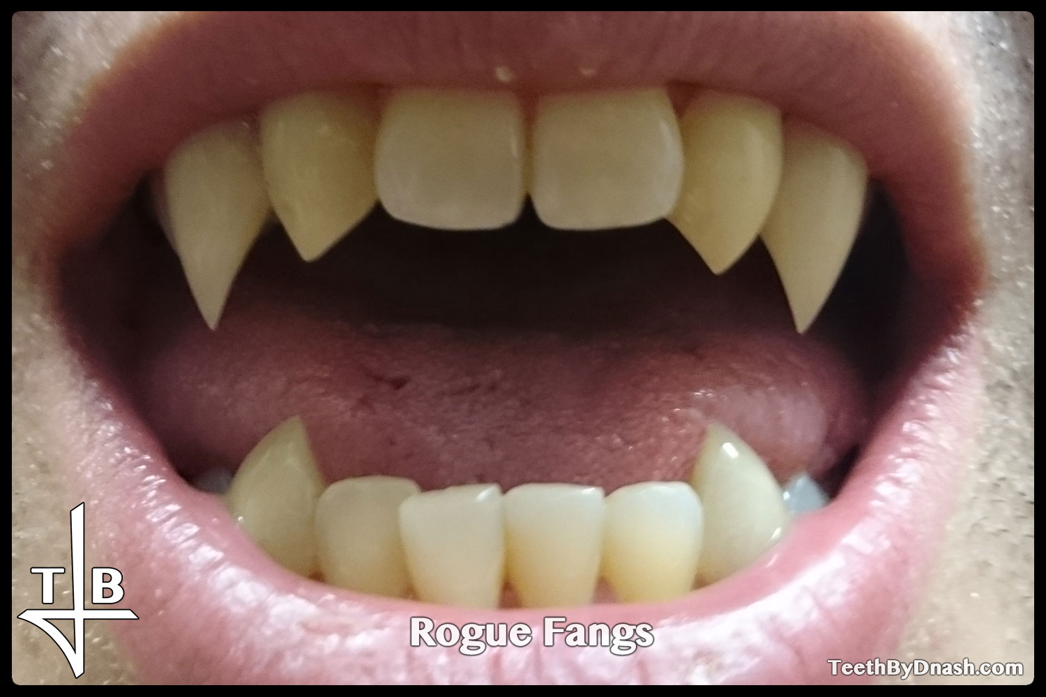 http://rogue-custom_fangs-teeth_by_dnash-04