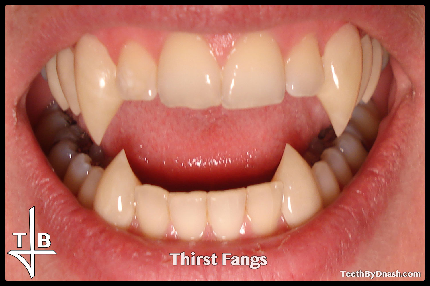 http://thirst-custom_fangs-teeth_by_dnash-01