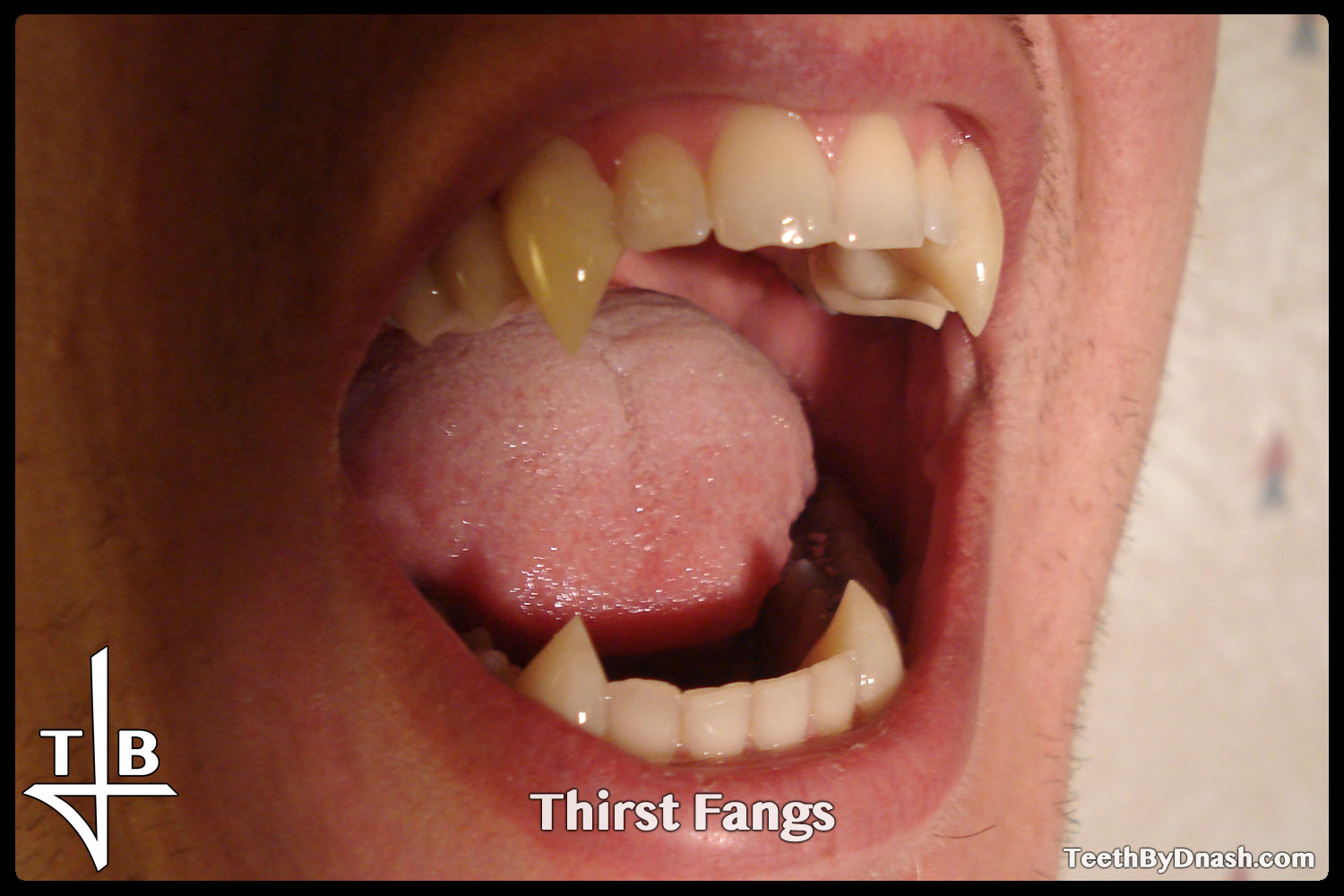 http://thirst-custom_fangs-teeth_by_dnash-02