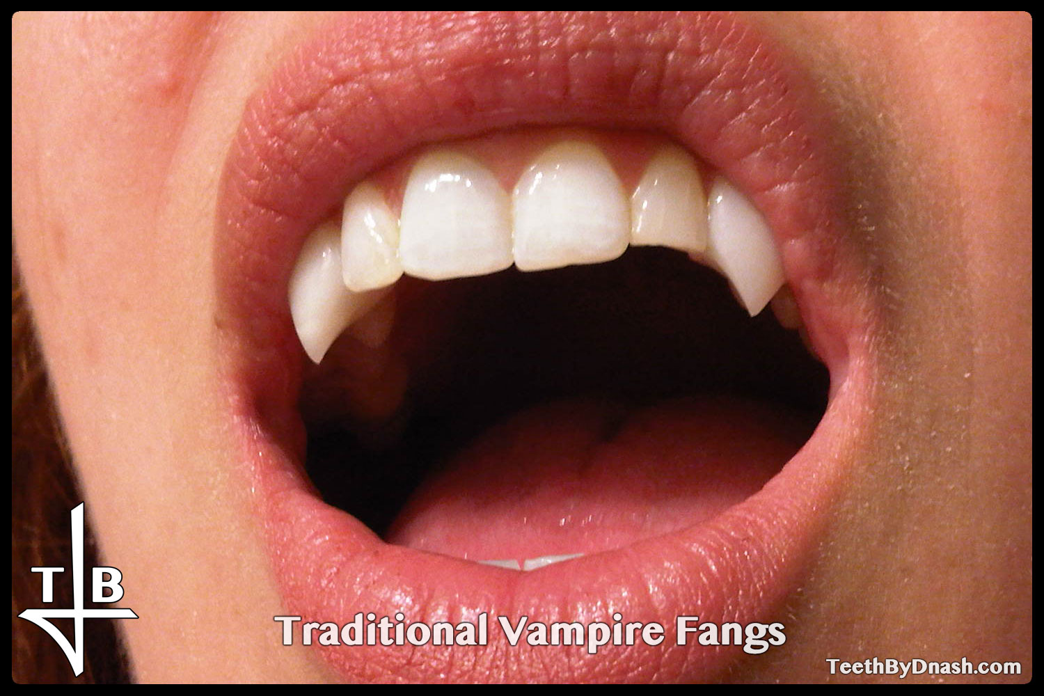 http://traditional_vampire-custom_fangs-teeth_by_dnash-02