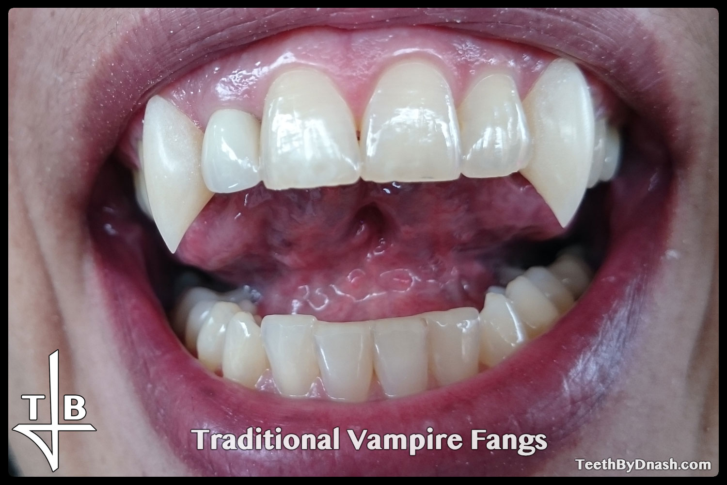 http://traditional_vampire-custom_fangs-teeth_by_dnash-07