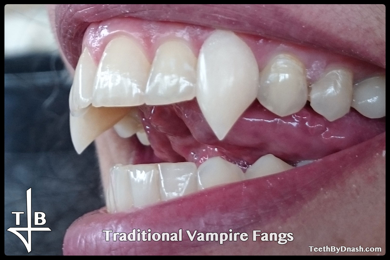 http://traditional_vampire-custom_fangs-teeth_by_dnash-08