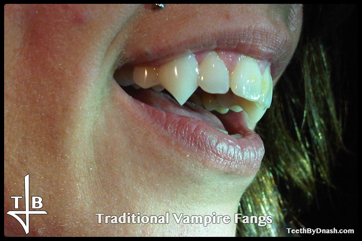 http://traditional_vampire-custom_fangs-teeth_by_dnash-19