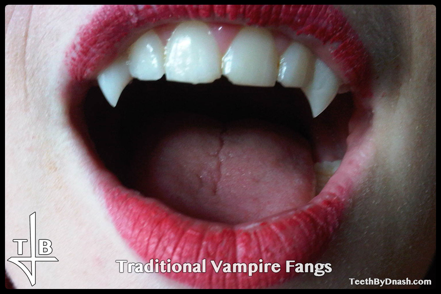http://traditional_vampire-custom_fangs-teeth_by_dnash-22