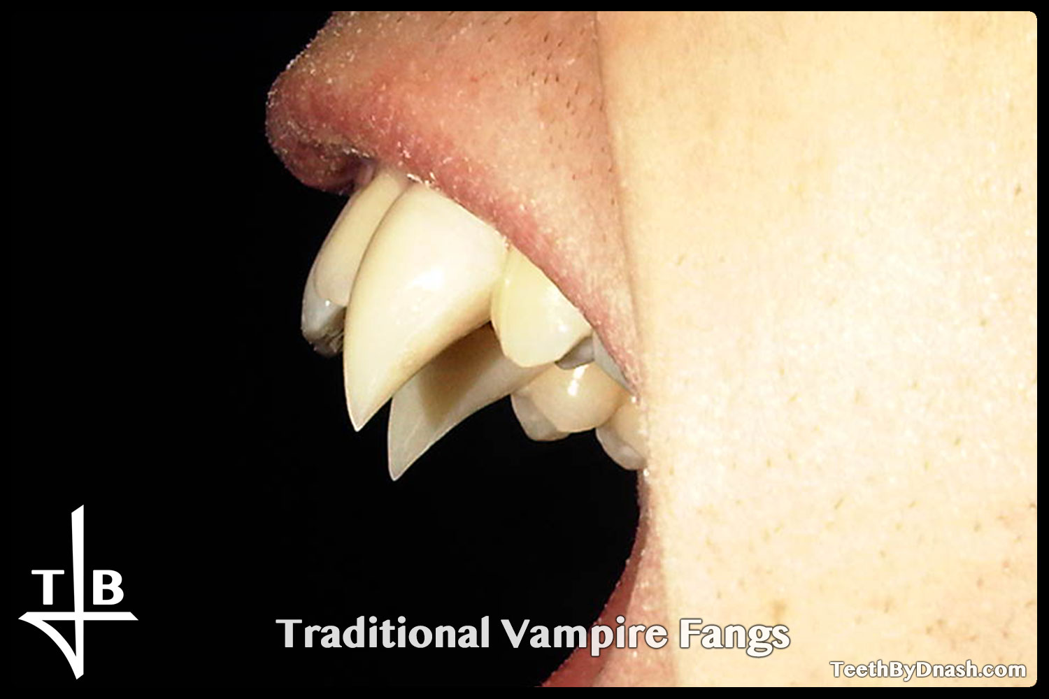 http://traditional_vampire-custom_fangs-teeth_by_dnash-26