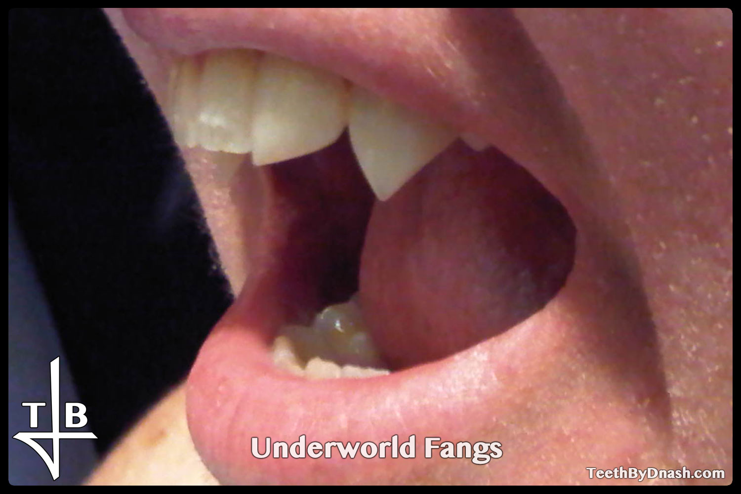 http://underworld-custom_fangs-teeth_by_dnash-15