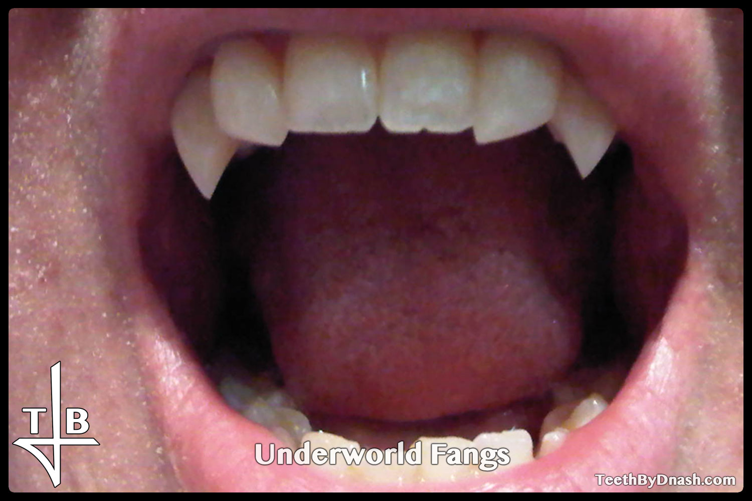 http://underworld-custom_fangs-teeth_by_dnash-16