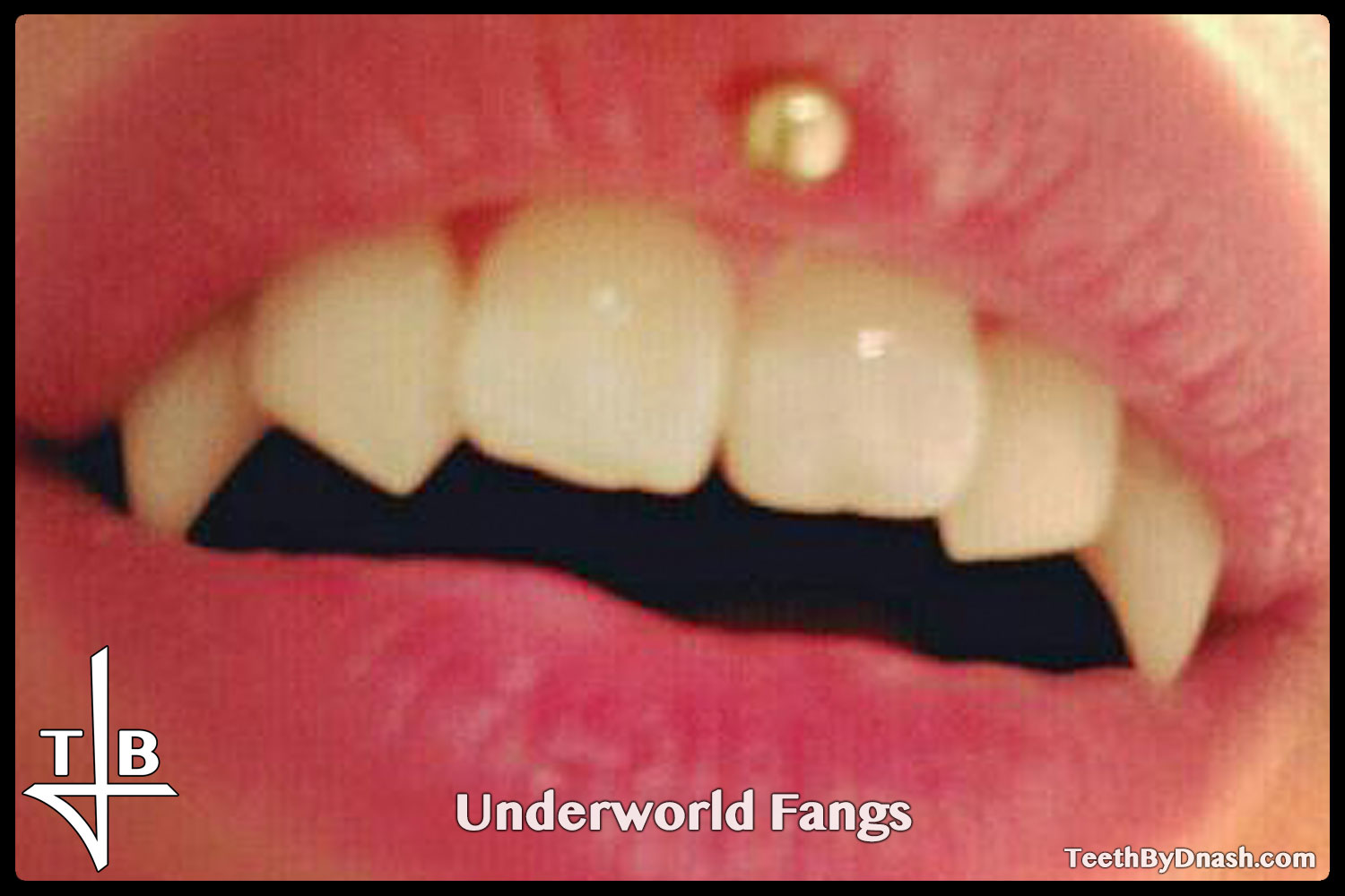 http://underworld-custom_fangs-teeth_by_dnash-21