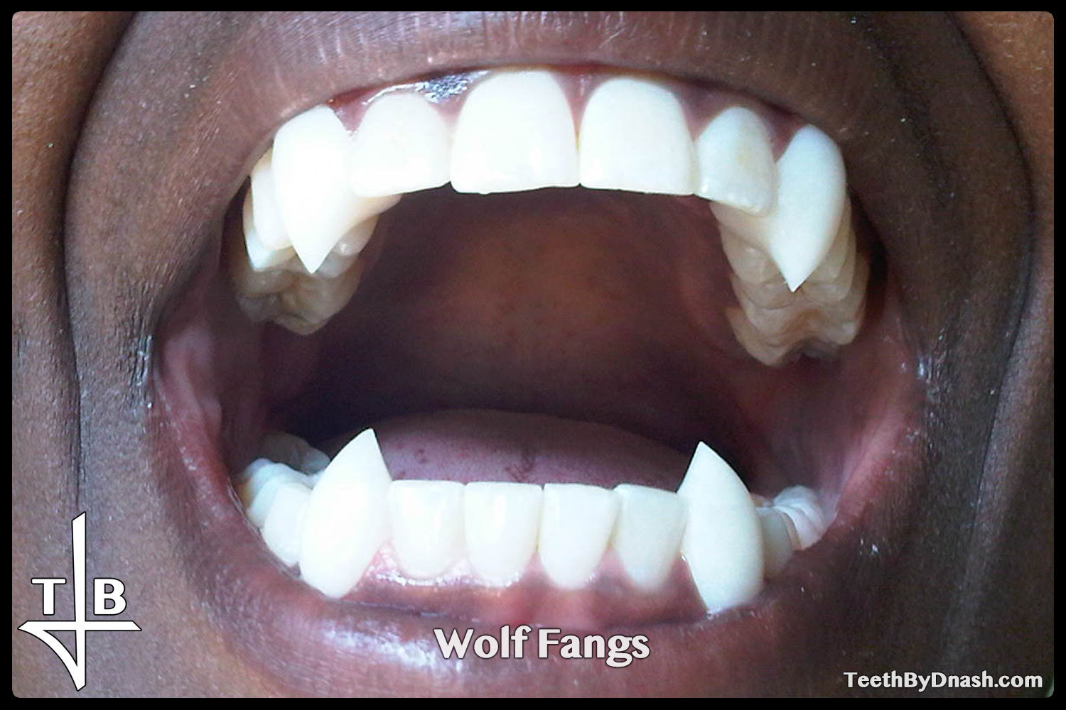 http://wolf-custom_fangs-teeth_by_dnash-02