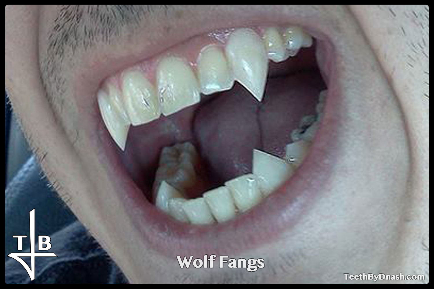 http://wolf-custom_fangs-teeth_by_dnash-07