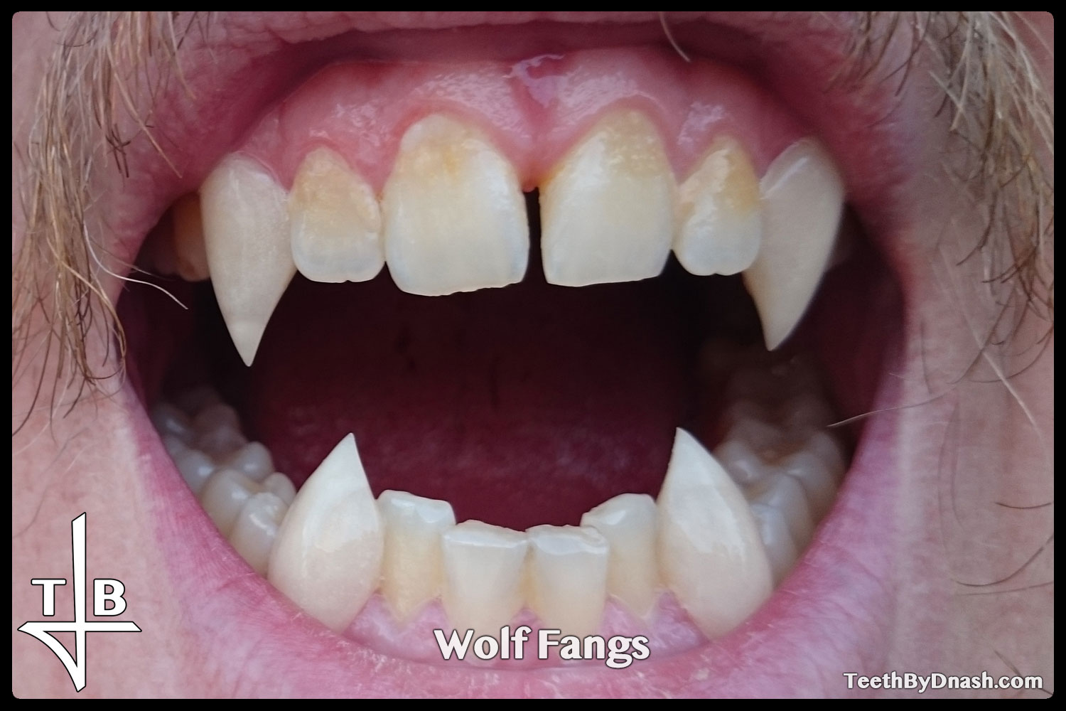 http://wolf-custom_fangs-teeth_by_dnash-10