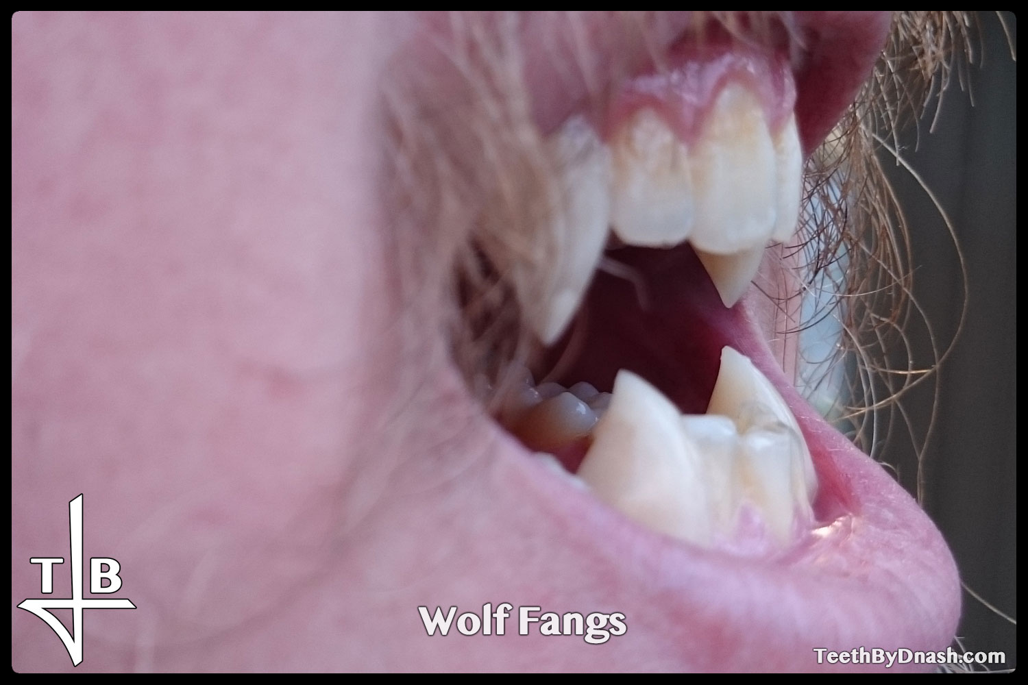 http://wolf-custom_fangs-teeth_by_dnash-11