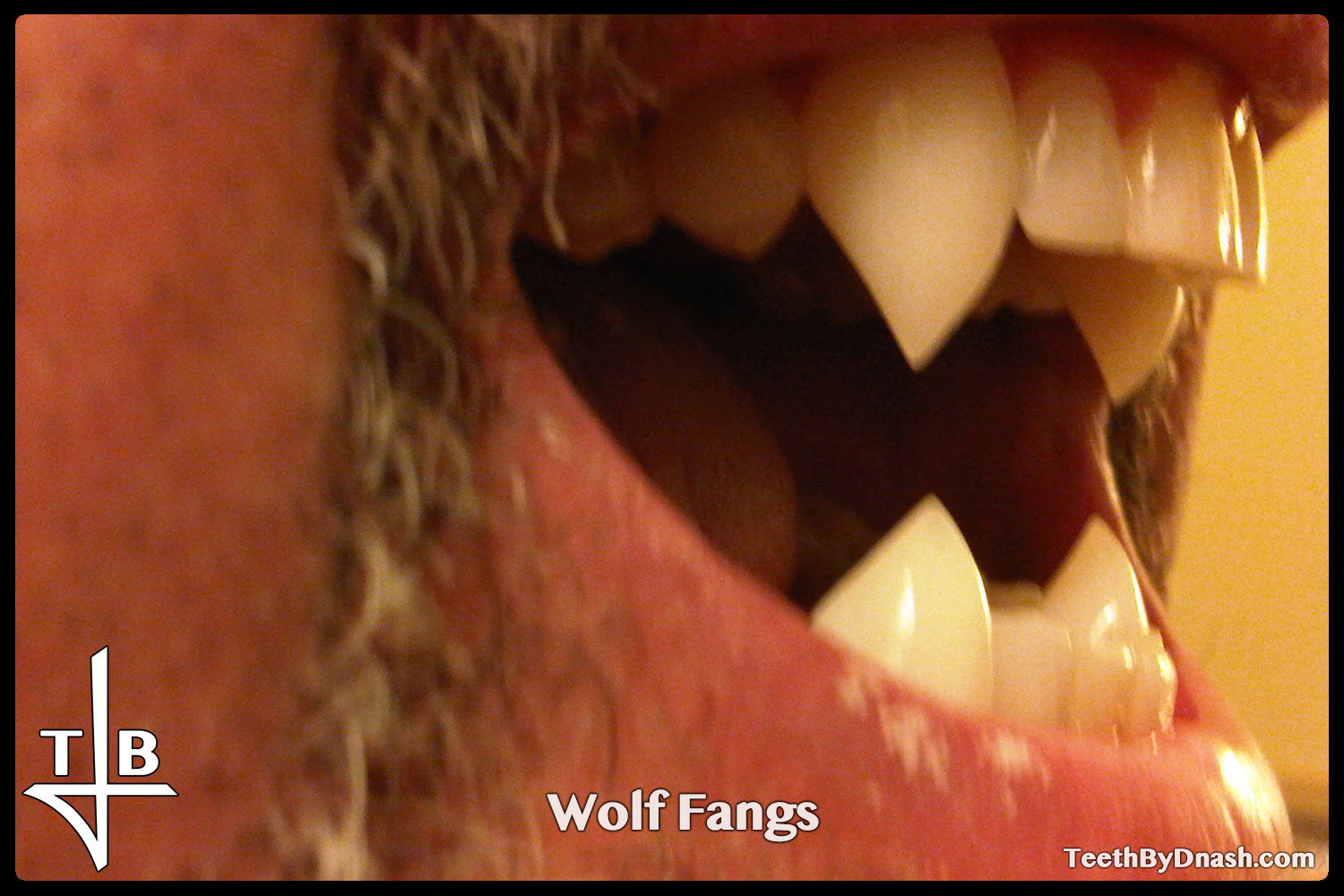 http://wolf-custom_fangs-teeth_by_dnash-14