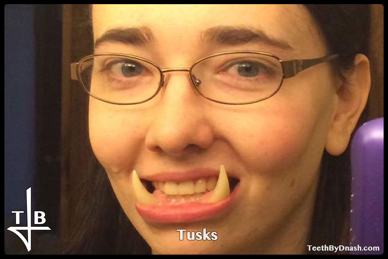 http://tusks-other_tooth_fx-teeth_by_dnash-12